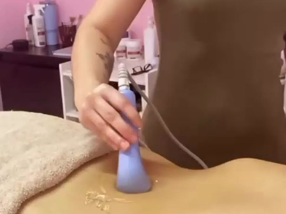 Caneta pressurizada aplicando o ativo na pele, sem agulha.