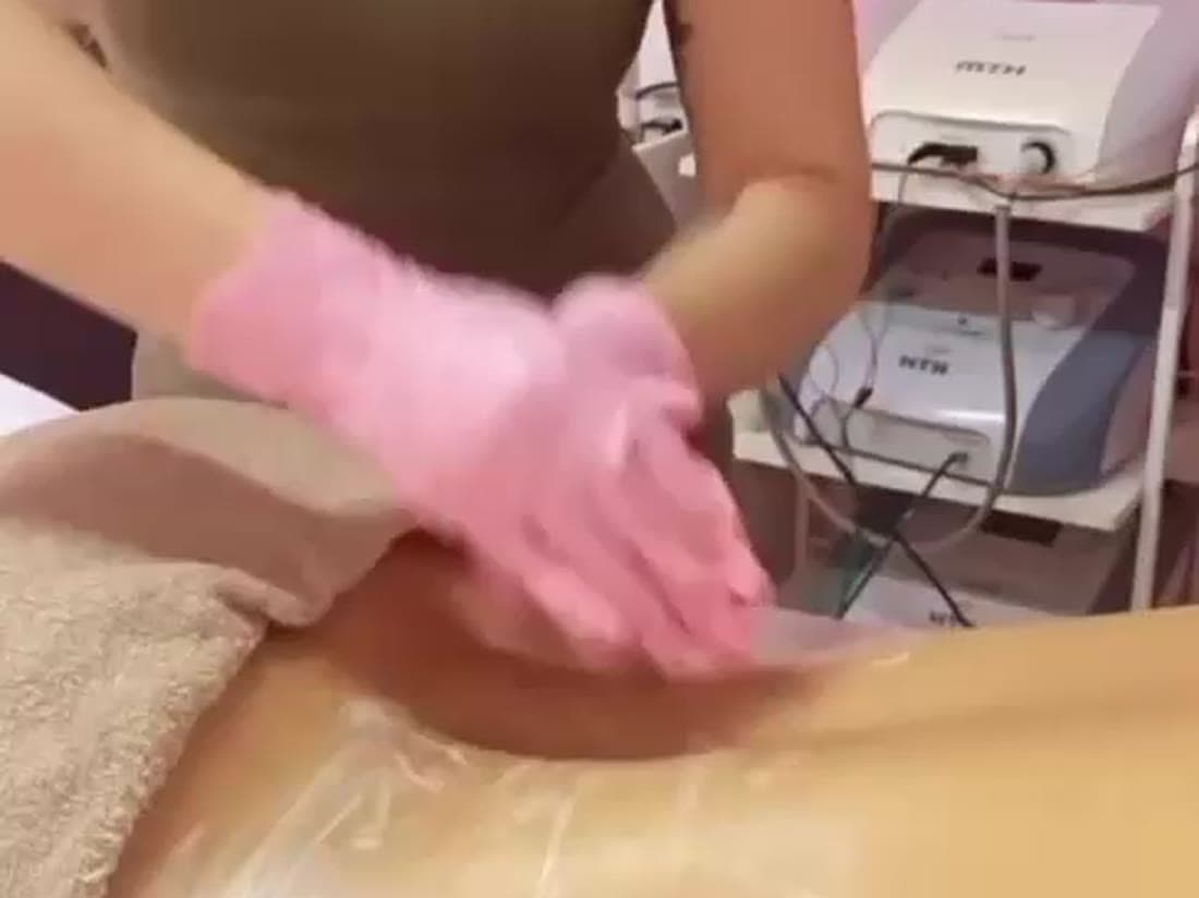 Massagem modeladora com produto no abdômen.